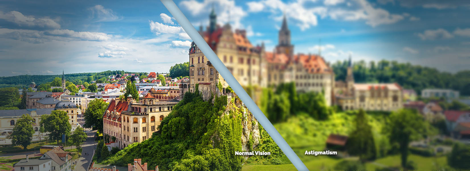 Astigmatism Treatment in Northeast Side