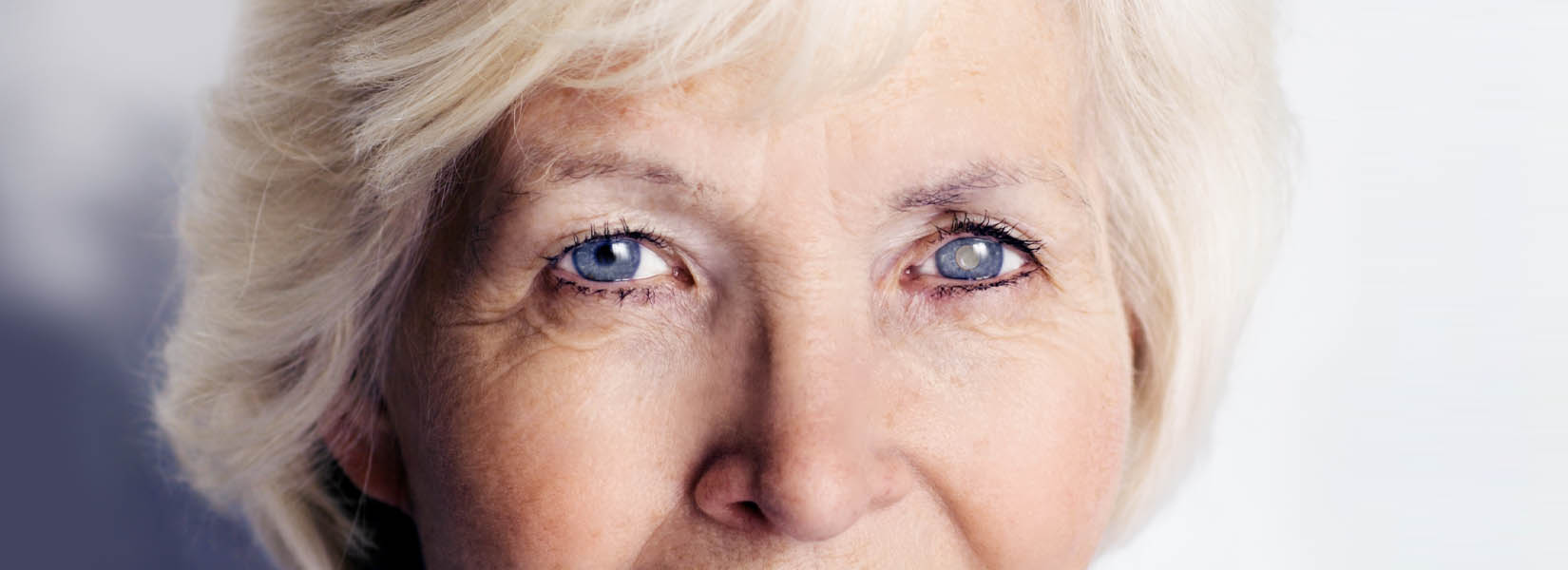 Cataract Surgery in Northeast Side